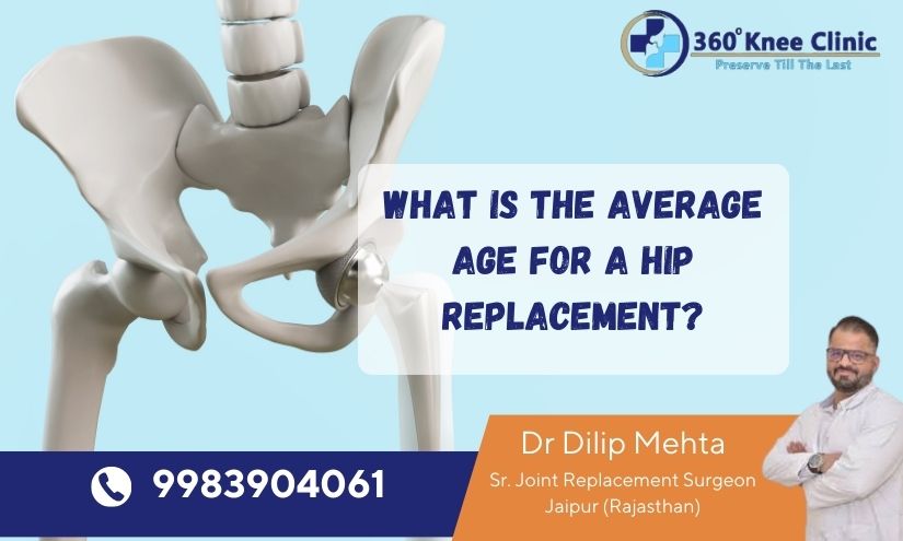 What is the Average Age for a Hip Replacement?